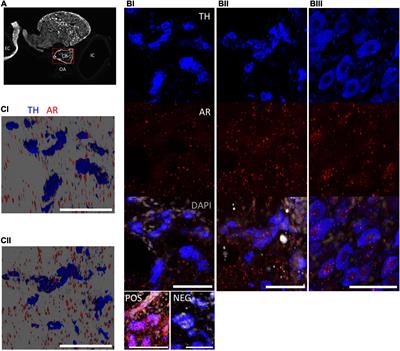 Testosterone Supplementation Induces Age-Dependent Augmentation of the Hypoxic Ventilatory Response in Male Rats With Contributions From the Carotid Bodies